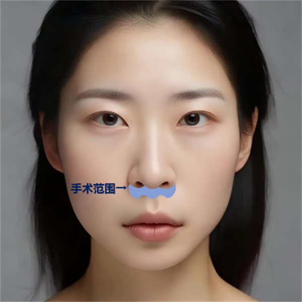 图片 39.jpg