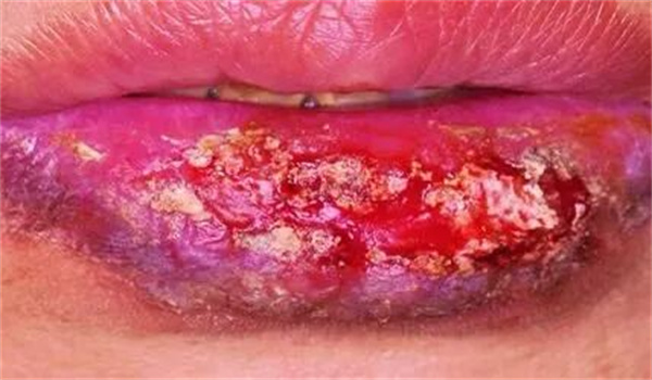 图片 62.jpg