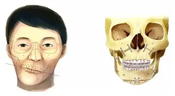 图片 85.jpg